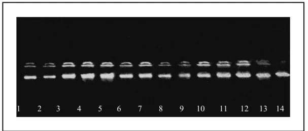 Figura 5. Gel representativo de DNAs de pacientes e controles. O gel possui amostras representativas  de DNA extraídos de pacientes com PCM (1 a 7) e controles (8 a 14) em gel de agarose 1% corado  com brometo de etídio (1 μl DNA + 9 μl H2O + 1,3 μl tampão