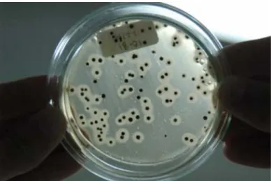 Figura 7.: Colônias características do gênero Staphylococcus  em  meio  de  cultura Baird Parker