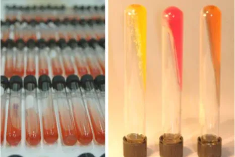 Figura 8. À esquerda, preparação do ágar Manitol-sal em tubo inclinado. À  direita, uma comparação entre um resultado positivo (amarelo), um negativo (rosa) e  um tubo não inoculado.