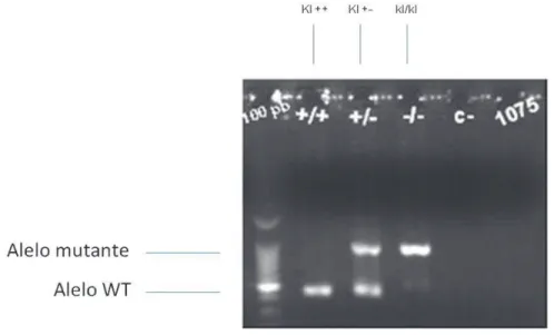 Figura 5.1 – Exemplo de genotipagem evidenciando os alelos mutante e “wild-type”(WT). 