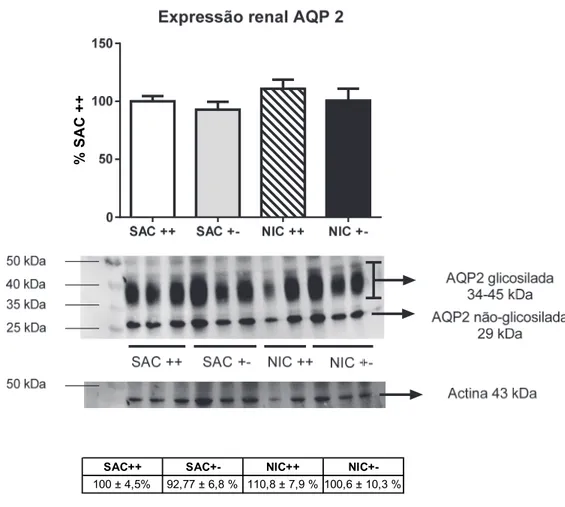 Figura 5.7 – Expressão renal da proteína aquaporina 2 (APQ2) foi semelhante em todos os  grupos, P  = 0,5 
