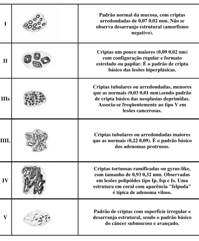 Figura 4: Classificação dos padrões de criptas conforme Kudo (1993). 
