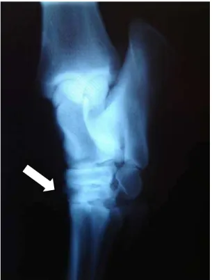 Figura 17 - Imagem radiográfica da articulação  tibiotársica direita do cavalo 3,  antes do tratamento - São Paulo -  2009 