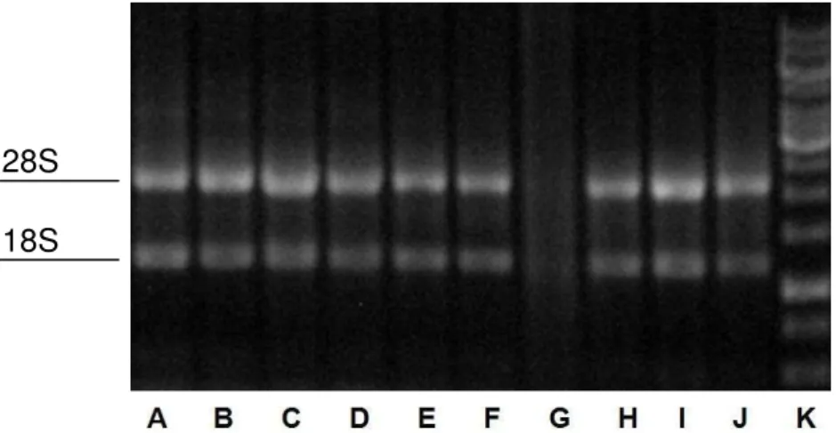 Figura 4. Eletroforese para avaliação da qualidade das amostras de RNA. De A a F: bandas das  subunidades 28S e 18S de rRNA, evidenciando amostras íntegras; G: amostra degradada; de H a J: 