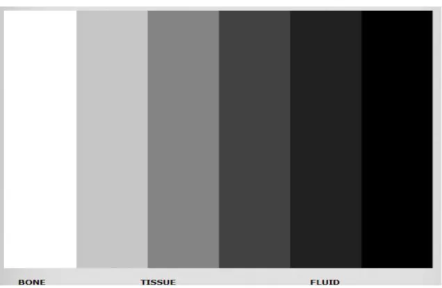 Figura  1-  Tons  de  cinzento  internacionalmente  estabelecidos  para  interpretação  de  imagens sonográficas