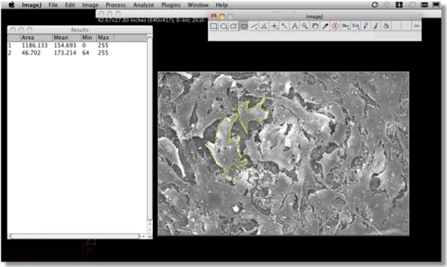 Figura 5 – Tela do programa Image J utilizado para avaliação da área de superfície óssea recoberta por células