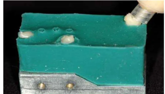 Figura 17 - Injeção da resina na base da  matriz de silicone e sobre as fibras  previamente posicionadas 