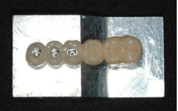 Figura 29 - Vista frontal do espécime  colocado na matriz de aço, pronto para  ser submetido ao teste de resistência à  fratura 
