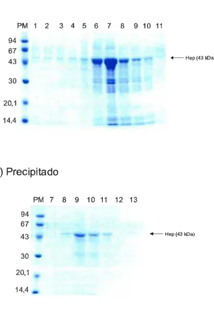 FIGURA 10 - Purificação da proteína HEP em cromatografia de afinidade por níquel - A proteína foi purificada por cromatografia de afinidade por níquel utilizando a resina