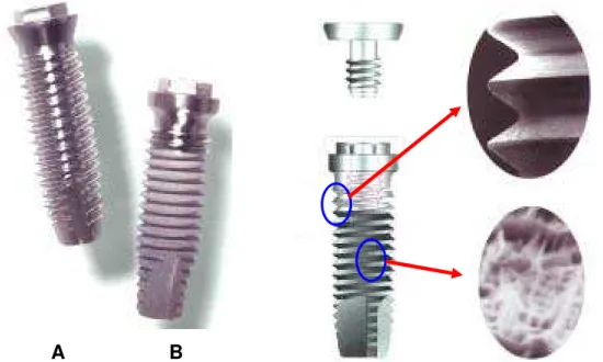 Fig. 2.1 – Alteração do formato das espiras para se obter melhor área  de contato ósseo e distribuição de forças