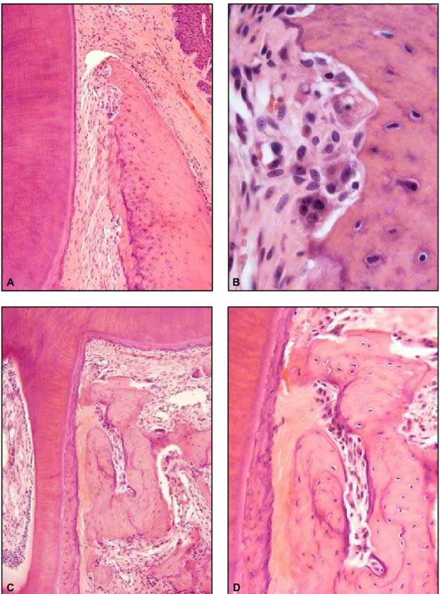 FiGurA  4  - Alterações morfológicas induzidas na região cervical da raiz mesial (A e B), submetida a forças  moderadas com reabsorção óssea frontal; na região cervical da raiz distal, submetida a forças intensas (c e D); no  Grupo experimental, após 3 dia
