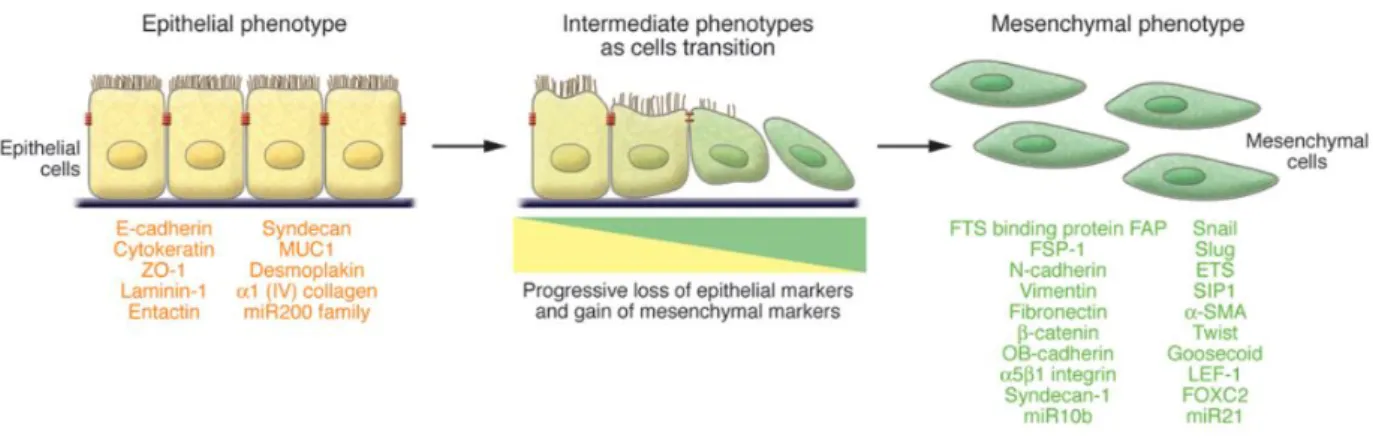 Figure 7 - Epithelial-mesenchymal transition (EMT) (71) 