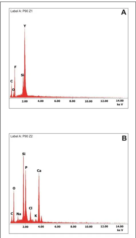Figura 5.  Representação gráfica dos dados obtidos no ensaio de EDX do  contra corpo   após ensaio tribológico (áreas Z1 e Z2, Figura  4,B)