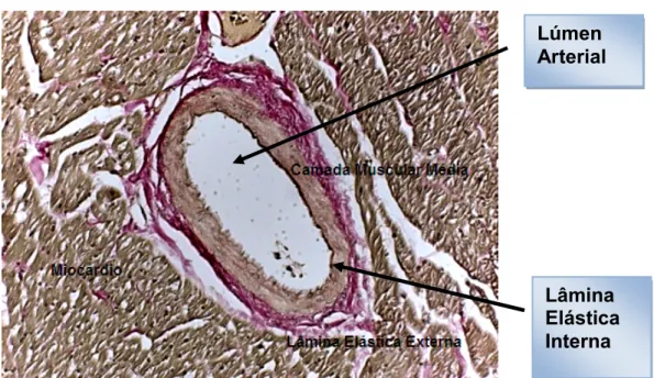 Figura 9. Corte histológico do miocárdio de coração nativo de coelho. Estão sendo sinalizados o miocárdio e no centro, artéria coronária com suas estruturas lâmina elástica externa, camada muscular média, e em destaque a lâmina elástica interna e o lúmen a