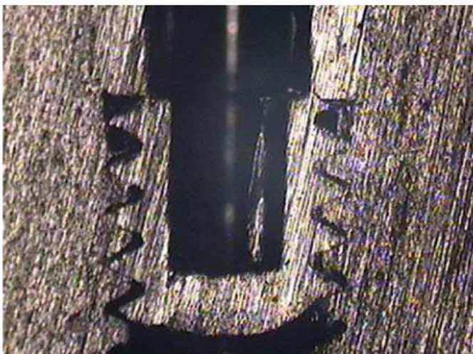 Fig. 8. Microscopia óptica de conjunto implante/pilar com parafuso fraturado,  revelando a fratura na região soldada do parafuso