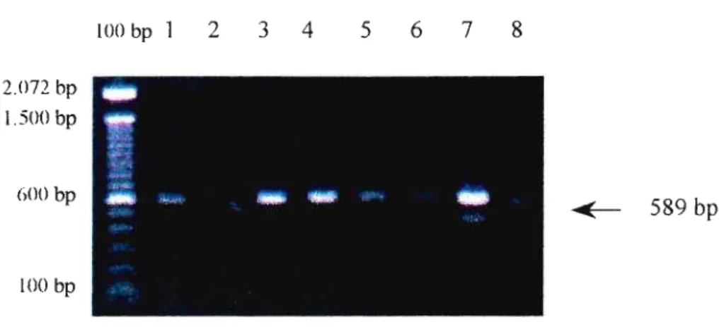 Figura 9. Produtos de PCR para M. hominis, para identificação de molicutes com crescimento em meio de Arginina, em gel de agarose a 0,8%