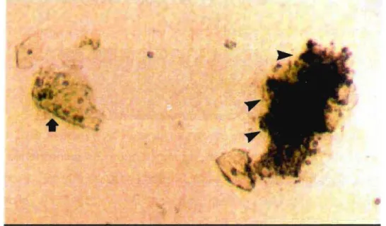 Figura 11. ｾ Colônias de Ureap/asma urea/yticum cultivadas de amostra clínica infectando células epiteliais em meio sólido A 7 (aumento de 40x).