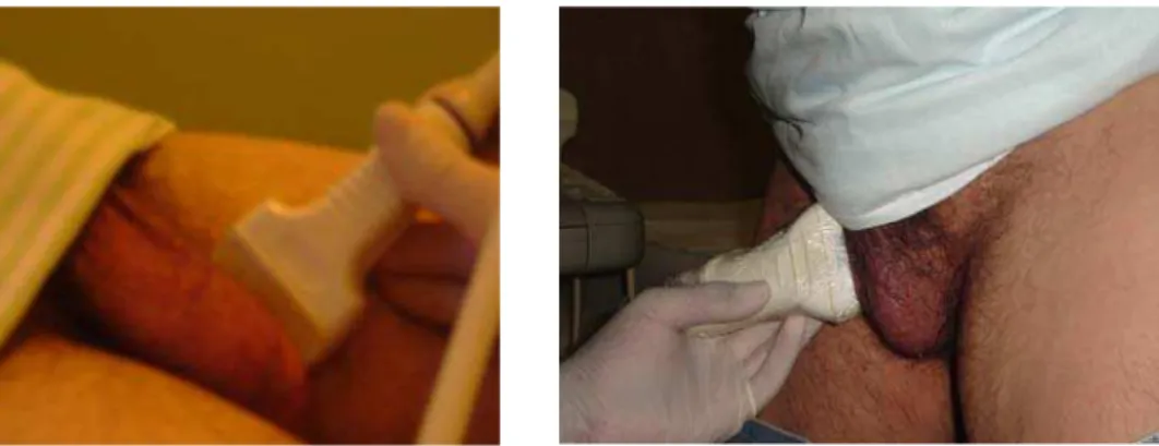 Figura 1 - Paciente na posição supina                   Figura 2 - Paciente na posição ortostática  OBS: Fotos com consentimento prévio dos pacientes