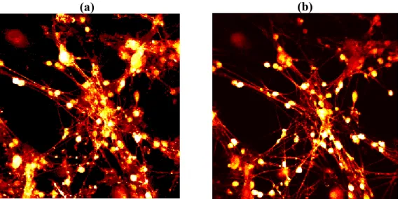 Figura 3.4. Imagem retirada da ref. (32) . Comparação entre imagens obtidas por microscopia de  fluorescência excitada por (a) 1 e (b) 2 fótons de células granulares do cerebelo