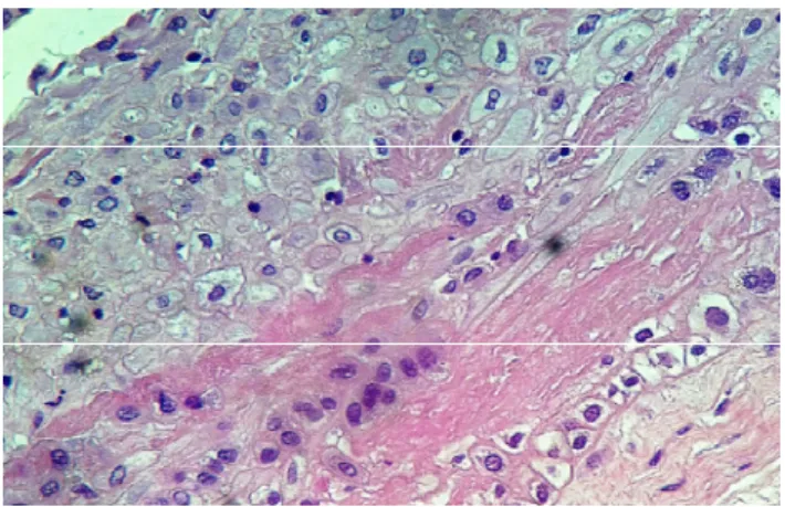 Figura  6:  Visualização  de  células  mesenquimais  e  fibroblastos.