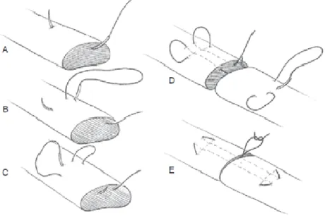 Figura 1 - Demonstração da realização do padrão de sutura locking loop 
