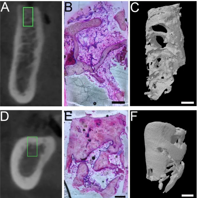 Figura 5.1 – Imagens comparativas entre métodos tomográficos e histomorfometria. 