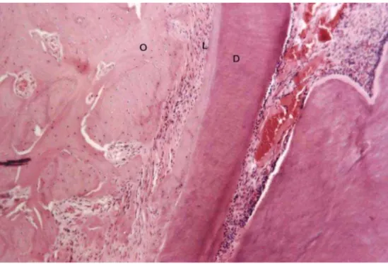 Figura 12 – Região cervical do lado de tensão da raiz mesiovestibular do Grupo 3. Notam-se  ligamento periodontal ricamente celularizado; superfície óssea periodontal regular; superfície  cementária uniforme