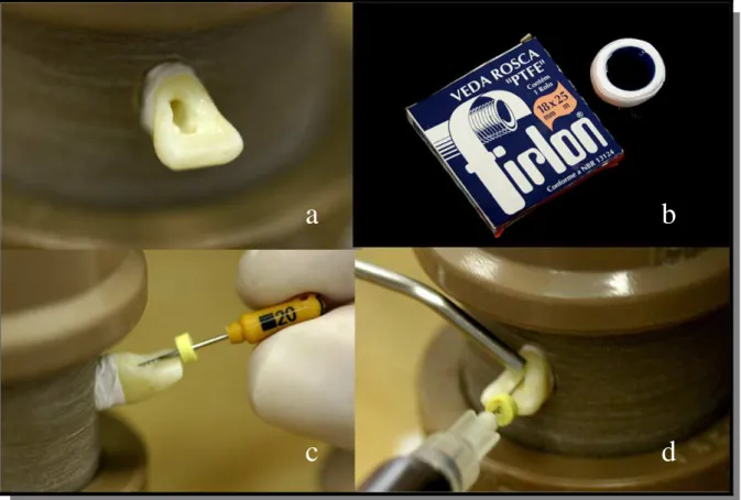Figura 11 - (a) Vista aproximada do dente; (b) Fita veda rosca utilizada; (c) Momento da  instrumentação; (d) Momento da irrigação e aspiração 