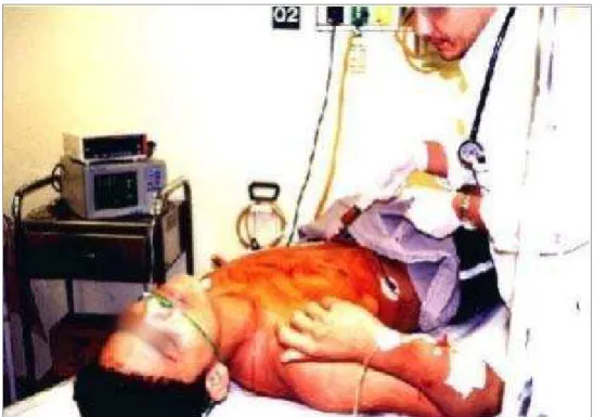 Figura 7 -  Pericardiocentese realizada na sala de emergência com monitorização  com ECG [Fonte: Arquivo do autor] 