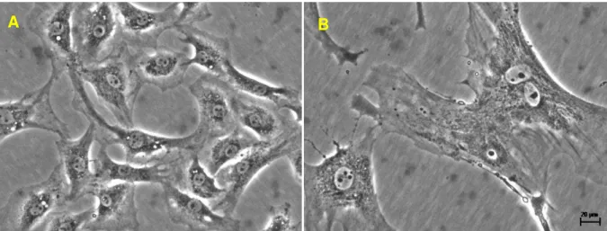 Figura  5  Fotomicrografias  da  cultura  de  CMLV.  Primeira  passagem  das  células  da  musculatura lisa vascular da aorta torácica de ratos Wistar (A) e SHR (B) com 12 semanas  de idade