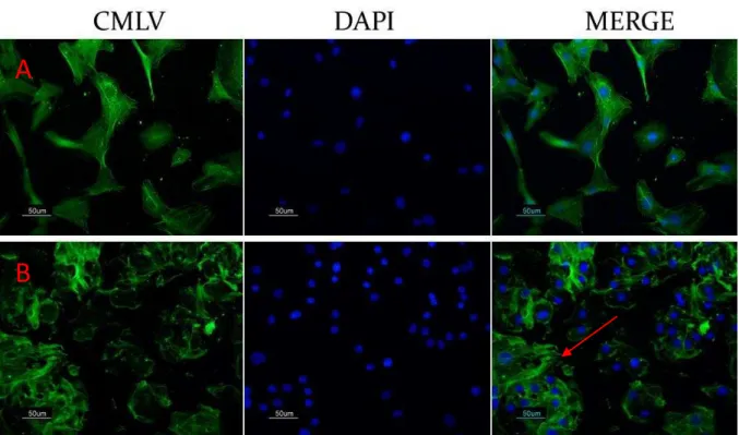 Figura 10 Efeito da ang II nas alterações vasculares moduladas pela transativação do  EGFR