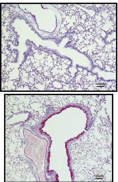 Figura  10.  Fotomicrografias  de  pulmões de  camundongos  BALB/c  corados  com PAS-AB, aumento 100X