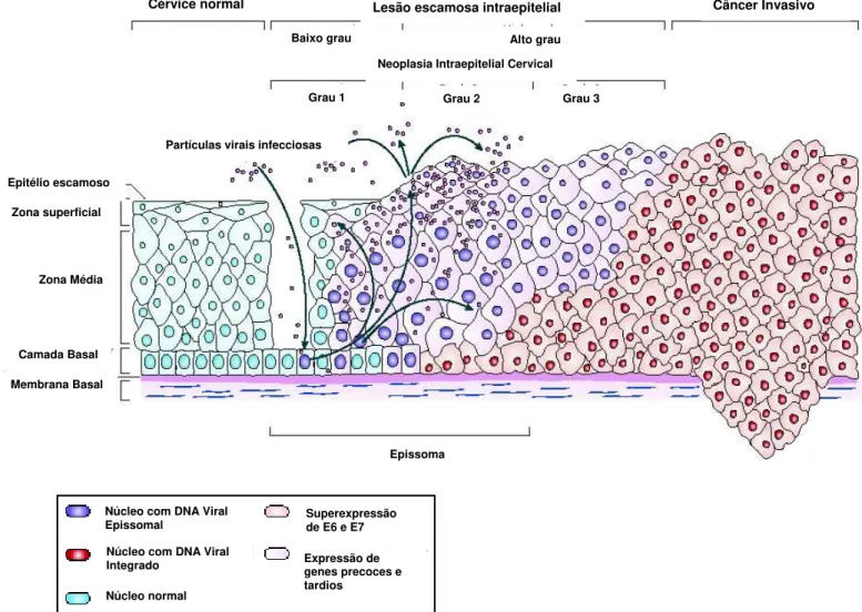 Figura 9: Progressão de câncer cervical mediado pelo HPV. Retirado de Woodman et al., 2007