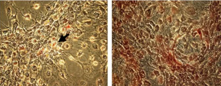 Figura 5: Atividade da fosfatase alcalina em células humanas derivadas do tecido adiposo, após 2 (figura  da  esquerda)  e  4  (figura  da  direita)  semanas  de  cultura  em  meio  osteogénico