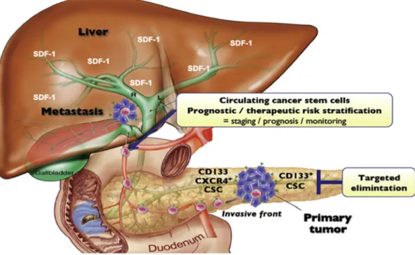 Figura 6 – Diferentes populações de células estaminais tumorais pancreáticas, entre as  quais uma subpopulação de CETS identificada pelos marcadores CXCR4/CD133
