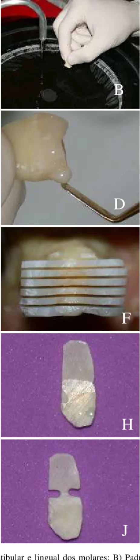 FIGURA 2  - A) Planificação das superfícies vestibular e lingual dos molares; B) Padronização  da “smear layer”