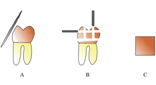 FIGURA 5  – A) Planificação da superfície vestibular dos molares; B) desgaste com  pontas diamantadas para obtenção do espécime quadrangular de esmalte; C) Espécime  de esmalte