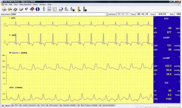 Figura 1  Monitorização contínua do eletrocardiograma, pressão arterial e  demais parâmetros hemodinâmicos 