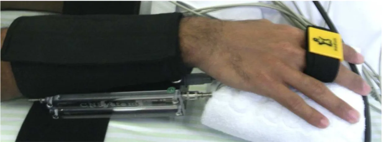 Figura 2  Sensor digital da pressão arterial, aquisição batimento a batimento 