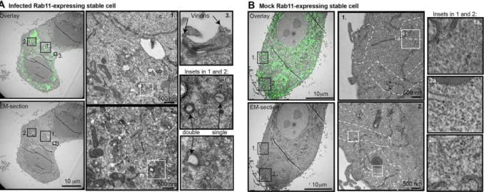 Figure 2. Ultrastructural features of Rab11 vesicular clustering revealed by CLEM technique 
