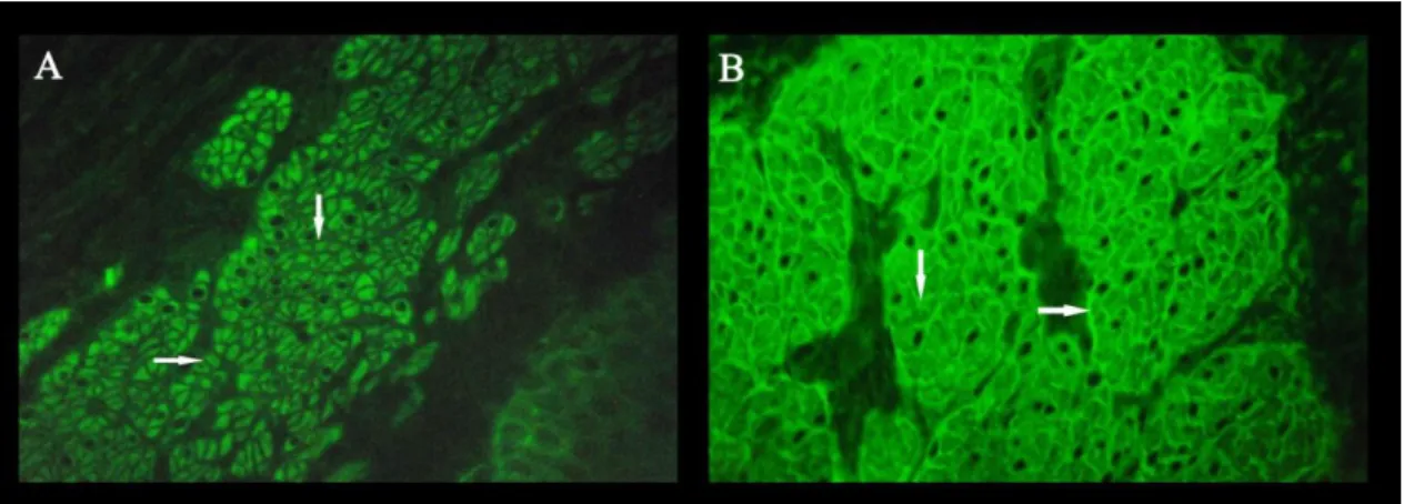 Figura 3 –  Cortes criostáticos transversais de esôfago de  macaco Rhesus fixados em lâmina  (Inova Diagnostics, Werfen company) e incubados com soro sanguíneo (diluição 1:5 em tampão  PBS)  para  detecção  de  anticorpos  IgA  ou  IgG