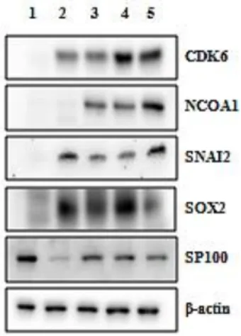 Figure  2 Comparison of  expression  levels of selected candidate proteins  in  fulvestrant-resistant  cell  lines  and  in  MCF-7/S0.5  cell  line  with  Western blotting