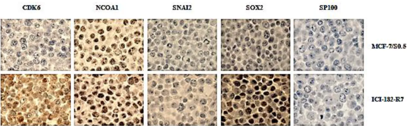 Figure  3  Comparison  of  expression  patterns  of  candidate  proteins  in  MCF-7/S0.5  and  ICI-182-R7  cell  lines analyzed by ICC