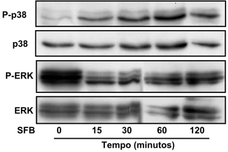 Figura 8 – Ativação das MAPKs em células estromais de crianças  saudáveis (CT2) estimuladas por SFB