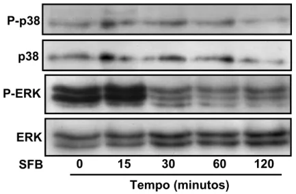 Figura 10 – Ativação das MAPKs em células estromais de crianças com  Síndrome Mielodisplásica (SMD2) estimuladas por SFB
