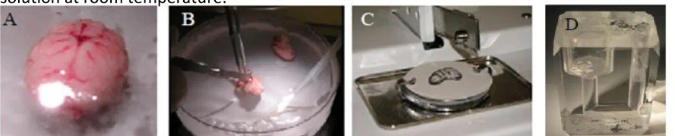 Figure  10  – Hippocampal  slices  preparation  –  (A)  Brain  removed. (B)  Hippocampus  isolation