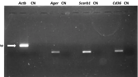 Figura  12.  Gel  de  agarose  corado  com  brometo  de  etídeo  evidenciando  a  amplificação de fragmentos dos genes  Actb, Ager, Scarb1 e Cd36 em ilhotas  pancreáticas de ratos
