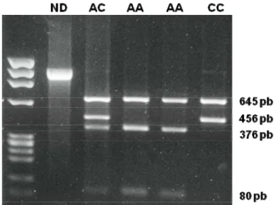 Figura 5: Foto de gel de agarose contendo produtos de digestão enzimática  para genotipagem do SNP p.Ile544Leu do  GHR: Fragmento de 1101 pb da  região de interesse (ND = fragmento não digerido) foi amplificado por PCR e  submetido a digestão pela enzima H