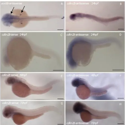Figure 5.1 - Expression of cdkn2b gene in zebrafish wt AB embryos. Whole-mount in situ hybridization  using gene specific  digoxigenin-labeled RNA in  embryos  staged at 24hpf (B, C, D), 48hpf (A,E,F) and 72hpf (G, H)