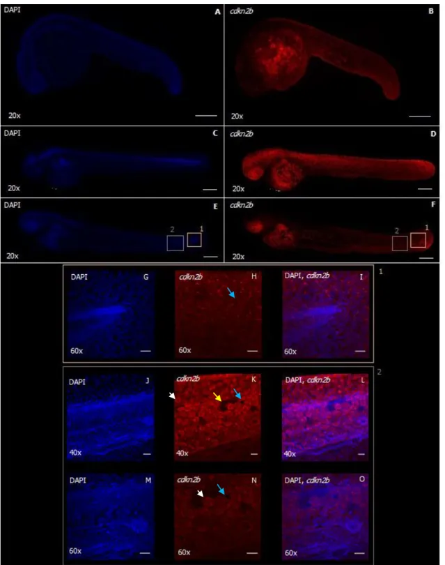 Figure 5.3 – Expression of cdkn2b protein in zebrafish embryos at 24hpf (A,B), 48hpf(C,D) and 72hpf(E,F)  detected by Immunohistochemistry using rat anti-Ink4b (primary antibody) and Alexa Fluor 568 anti-rat (secondary  antibody)